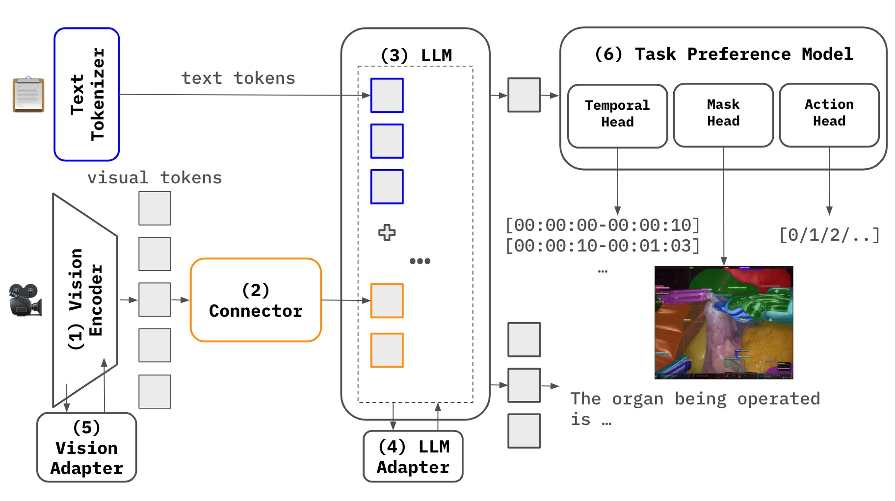 Interpretable Surgical Navigation via VLA